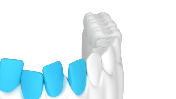 Plaster Jaw Teeth Straightening White Background — 图库视频影像