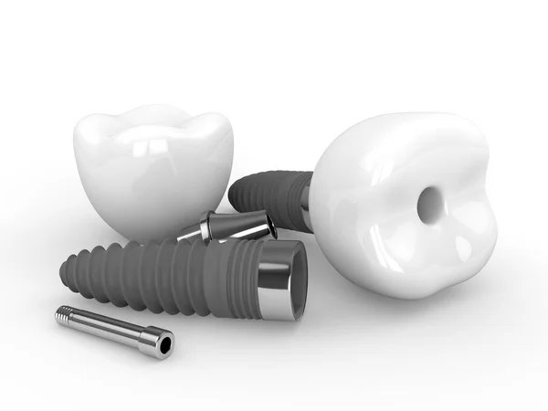 Renderowanie Implantów Stomatologicznych Leżących Białym Stole — Zdjęcie stockowe