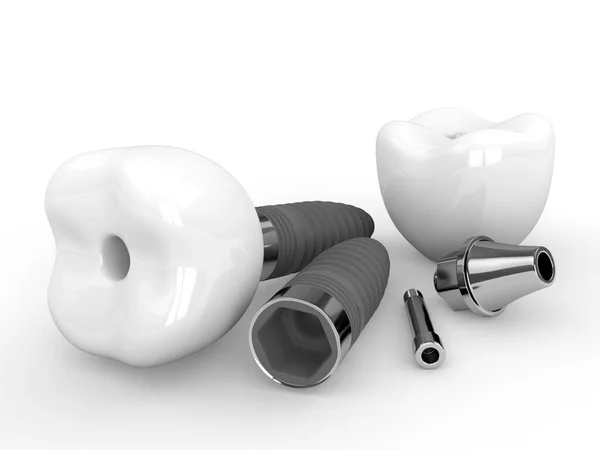 Renderelés Fogászati Implantátumok Fekvő Fehér Asztal Stock Fotó