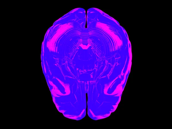 3D ludzkiego mózgu — Zdjęcie stockowe