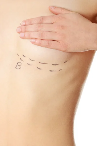 Woman's breasts marked with lines — Stock Photo, Image