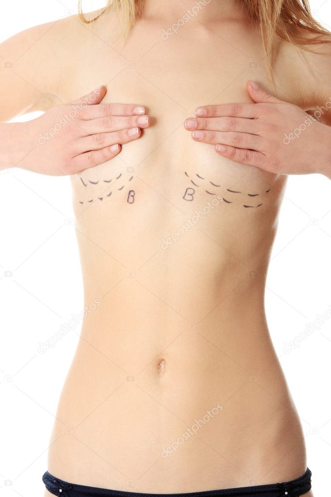 Woman's breasts marked with lines