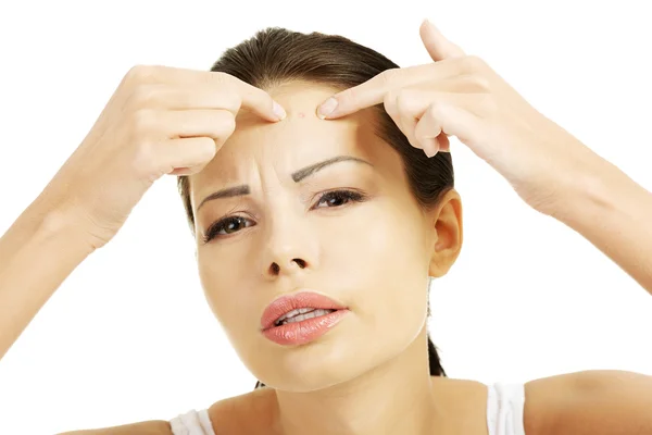 Young woman with pimple on her face. — Stock Photo, Image