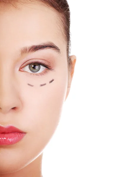 Woman marked out for cosmetic surgery. — Stock Photo, Image