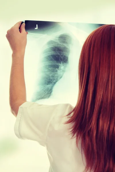 Göğüs röntgeni — Stok fotoğraf