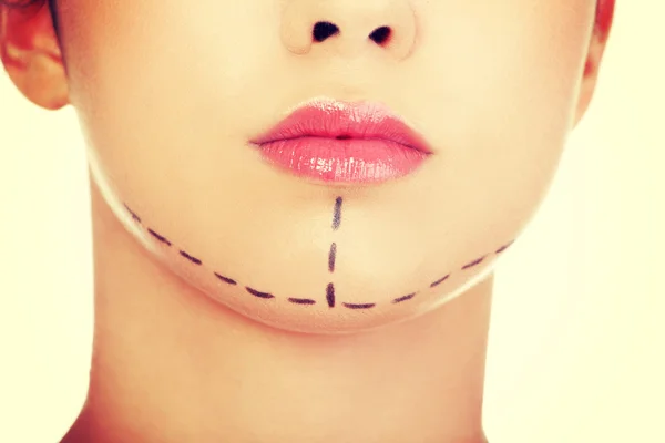 Cosmetic  surgery. — Stock Photo, Image