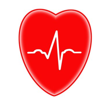 EKG grafiği