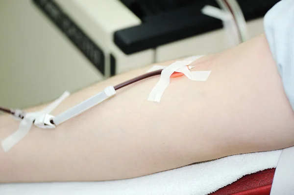 Transfusão de sangue — Fotografia de Stock