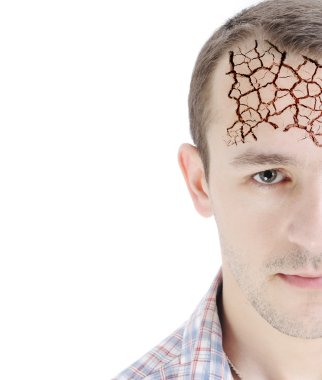 Man's head, isolated on white, half-faced, dry forehead skin, conceptual photo clipart