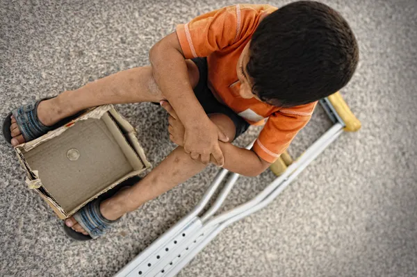 Chico hambriento mendigando en la calle con unas muletas al lado — Foto de Stock