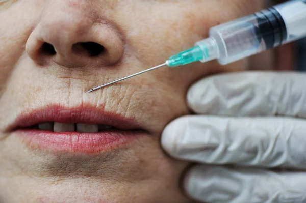 Needle injection on mature woman face — Stock Photo, Image