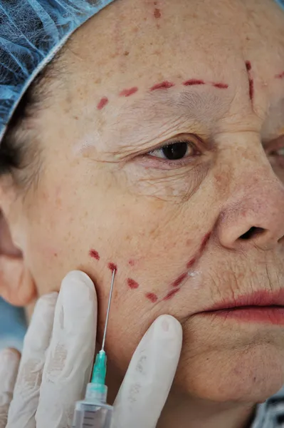 Mujer mayor que recibe la inyección de botox en el hospital —  Fotos de Stock
