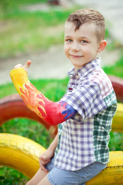 Portret van jongen met een gebroken arm — Stockfoto