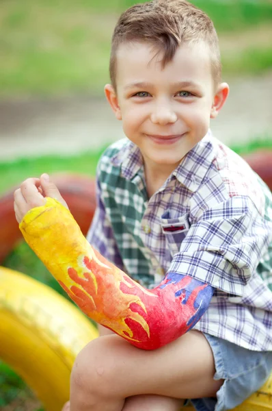 Portret van jongen met een gebroken arm — Stockfoto