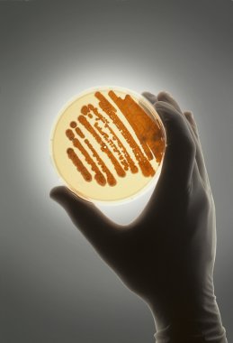 R&D için kullanılan bakteri ile Petrie çanak