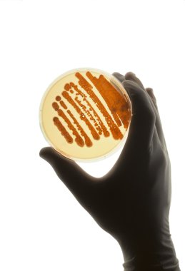 R&D için kullanılan bakteri ile Petrie çanak