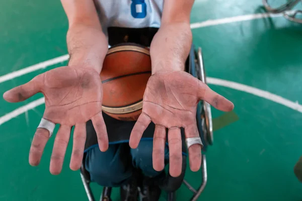 在竞技场上一场精疲力尽的比赛之后 被残疾的篮球运动员所控制的手 有选择的重点 高质量的照片 — 图库照片