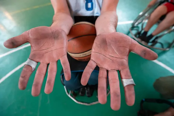 Mãos Jogadores Basquete Deficientes Após Jogo Exaustivo Arena Foco Seletivo — Fotografia de Stock