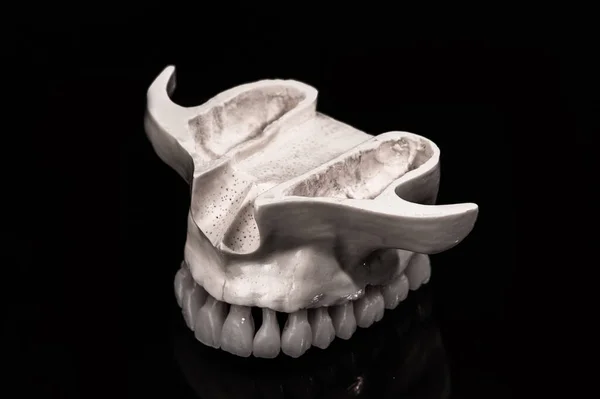 Mandíbula Humana Inferior Com Modelo Anatomia Dos Dentes Isolado Fundo — Fotografia de Stock