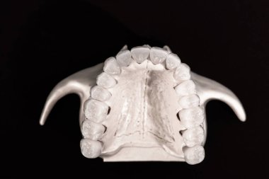 Diş anatomisi modeli siyah arka planda izole edilmiş insan çenesi. Sağlıklı dişler, diş bakımı ve ortodontik tıbbi konsept. Merhaba kaliteli fotoğraf.