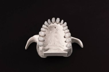 Diş anatomisi modeli siyah arka planda izole edilmiş insan çenesi. Sağlıklı dişler, diş bakımı ve ortodontik tıbbi konsept. Merhaba kaliteli fotoğraf.