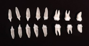 Siyah arka planda protez dişler Ağız hijyeni diş sağlığı konsepti Ağız bakımı diş restorasyonu üst görünümü. Merhaba kaliteli fotokopi alanı fotoğrafı.