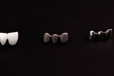 Diş implantı ve taç yerleştirme işleminin parçaları siyah arka planda izole edilmiş. Tıbben doğru 3D model. Merhaba kaliteli fotokopi alanı fotoğrafı. 