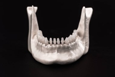 Diş anatomisi modeli siyah arka planda izole edilmiş insan çenesi. Sağlıklı dişler, diş bakımı ve ortodontik sağlık konsepti. Fotokopi alanı olan kaliteli fotoğraf.