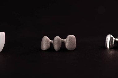 Diş implantı ve taç yerleştirme işleminin parçaları siyah arka planda izole edilmiş. Tıbben doğru 3D model. Merhaba kaliteli fotokopi alanı fotoğrafı. 