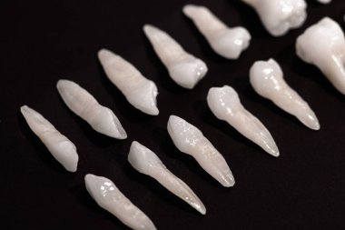 Siyah arka planda protez dişler Ağız hijyeni diş sağlığı konsepti Ağız bakımı diş restorasyonu üst görünümü. Merhaba kaliteli fotokopi alanı fotoğrafı.