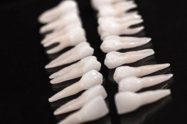 Siyah arka planda protez dişler Ağız hijyeni diş sağlığı konsepti Ağız bakımı diş restorasyonu üst görünümü. Merhaba kaliteli fotokopi alanı fotoğrafı.