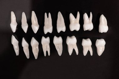 Siyah arka planda protez dişler Ağız hijyeni diş sağlığı konsepti Ağız bakımı diş restorasyonu üst görünümü. Merhaba kaliteli fotokopi alanı fotoğrafı.