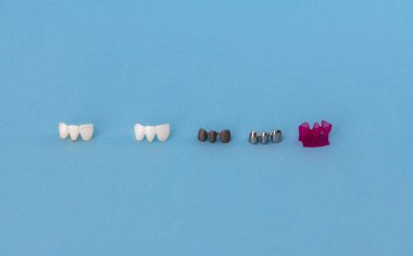 Diş implantı ve taç yerleştirme işlemi parçaları mavi arka planda izole edilmiş. Tıbben doğru 3D model. Merhaba kaliteli fotokopi alanı fotoğrafı. 