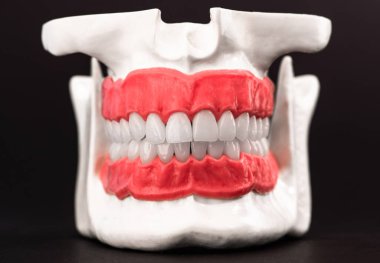 Dişleri ve diş etleri olan insan çenesi. Siyah arka planda izole edilmiş anatomi modeli. Sağlıklı dişler, diş bakımı ve ortodontik sağlık konsepti. Yüksek kalite kopya alanı fotoğrafı. 