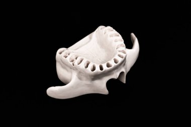 Diş modelsiz üst insan çenesi siyah arka planda izole edilmiş tıbbi implant. Sağlıklı dişler, diş bakımı ve ortodontik konsept. Merhaba kaliteli kopyalama alanı.