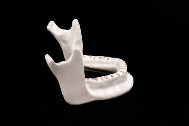 Diş modelsiz üst insan çenesi siyah arka planda izole edilmiş tıbbi implant. Sağlıklı dişler, diş bakımı ve ortodontik konsept. Merhaba kaliteli kopyalama alanı.