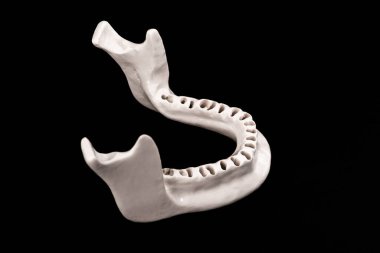 Diş modelsiz üst insan çenesi siyah arka planda izole edilmiş tıbbi implant. Sağlıklı dişler, diş bakımı ve ortodontik konsept. Merhaba kaliteli kopyalama alanı.