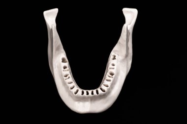 Diş modelsiz üst insan çenesi siyah arka planda izole edilmiş tıbbi implant. Sağlıklı dişler, diş bakımı ve ortodontik konsept. Merhaba kaliteli kopyalama alanı.