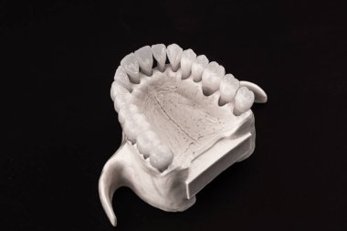 Diş anatomisi modeli siyah arka planda izole edilmiş insan çenesi. Sağlıklı dişler, diş bakımı ve ortodontik tıbbi konsept. Merhaba kaliteli fotoğraf.