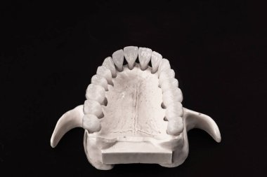 Diş anatomisi modeli siyah arka planda izole edilmiş insan çenesi. Sağlıklı dişler, diş bakımı ve ortodontik tıbbi konsept. Merhaba kaliteli fotoğraf.