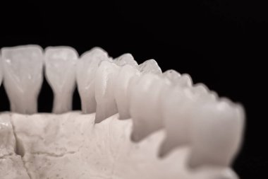 Diş anatomisi modeli siyah arka planda izole edilmiş insan çenesi. Sağlıklı dişler, diş bakımı ve ortodontik tıbbi konsept. Merhaba kaliteli fotoğraf.