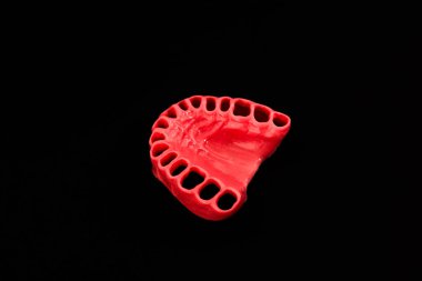 Diş eti olmayan insan diş etleri siyah arka planda izole edilmiş tıbbi implant. Sağlıklı dişler, diş bakımı ve ortodontik konsept. Merhaba kaliteli kopyalama alanı.