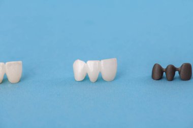 Diş implantı ve taç yerleştirme işlemi parçaları mavi arka planda izole edilmiş. Tıbben doğru 3D model. Merhaba kaliteli fotokopi alanı fotoğrafı. 