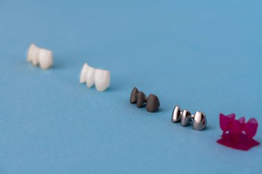 Diş implantı ve taç yerleştirme işlemi parçaları mavi arka planda izole edilmiş. Tıbben doğru 3D model. Merhaba kaliteli fotokopi alanı fotoğrafı. 