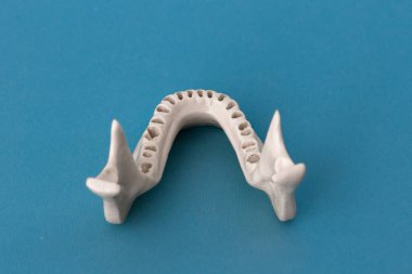 Diş modelsiz üst insan çenesi mavi arka planda izole edilmiş tıbbi implant. Sağlıklı dişler, diş bakımı ve ortodontik konsept. Merhaba kaliteli kopyalama alanı.
