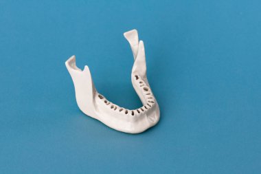Diş modelsiz üst insan çenesi mavi arka planda izole edilmiş tıbbi implant. Sağlıklı dişler, diş bakımı ve ortodontik konsept. Merhaba kaliteli kopyalama alanı.