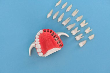 Diş implantı ve taç yerleştirme işlemi parçaları mavi arka planda izole edilmiş. Tıbben doğru 3D model. hI Kalifiye 3D Kopyalama Aralığı Modeli. 
