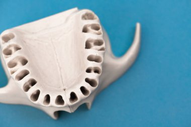 Diş modelsiz üst insan çenesi mavi arka planda izole edilmiş tıbbi implant. Sağlıklı dişler, diş bakımı ve ortodontik konsept. Merhaba kaliteli kopyalama alanı.