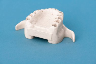 Diş modelsiz üst insan çenesi mavi arka planda izole edilmiş tıbbi implant. Sağlıklı dişler, diş bakımı ve ortodontik konsept. Merhaba kaliteli kopyalama alanı.