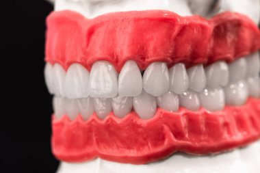 Dişleri ve diş etleri olan insan çenesi. Siyah arka planda izole edilmiş anatomi modeli. Sağlıklı dişler, diş bakımı ve ortodontik sağlık konsepti. Yüksek kalite kopya alanı fotoğrafı. 